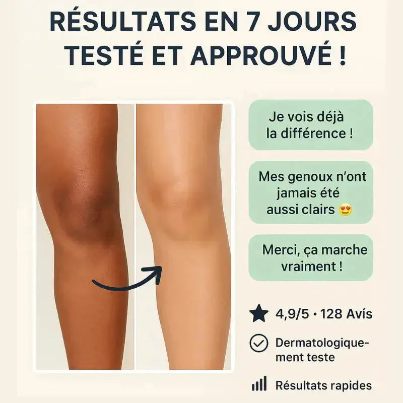 Dites adieu aux taches sombres sur vos genoux, coudes et aisselles en seulement 7 jours ! (1 ACHETÉ, 1 OFFERT)